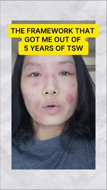 @Grace | TSW & Eczema Recovery