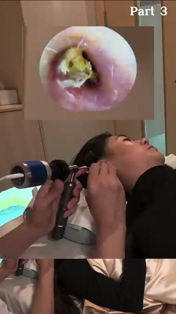 @ASMR Ear Cleaning