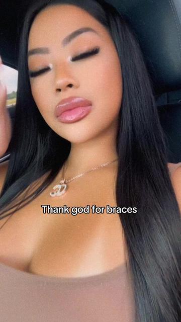 @ceexoxxo