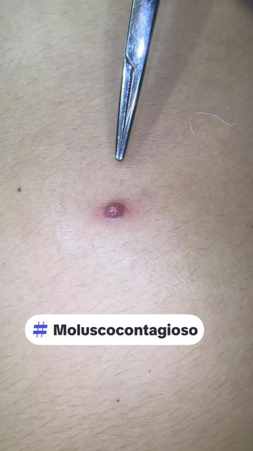 @Dr. Wilfrido Solano Derma