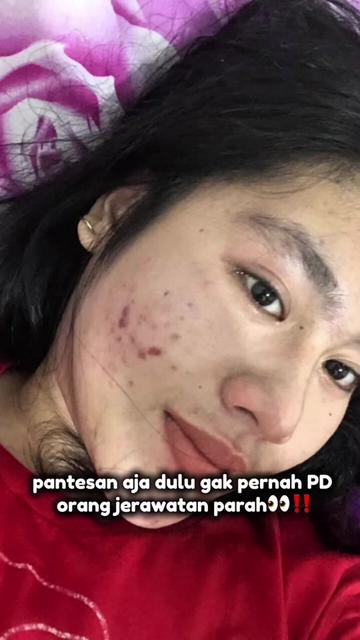 @Sally Marcelina🎀