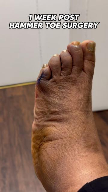 @Best Foot Doctor NY