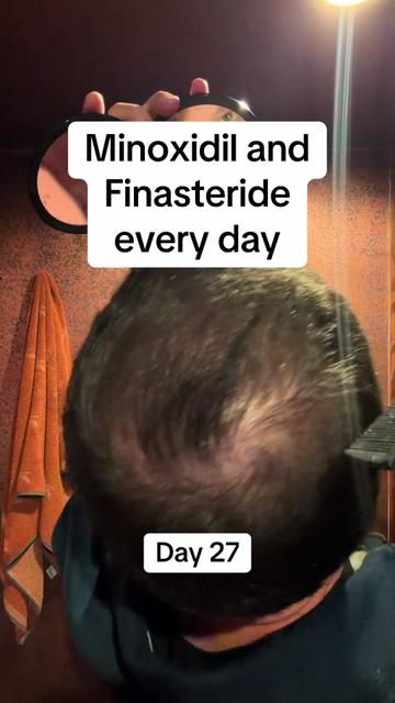 @scalp.hero