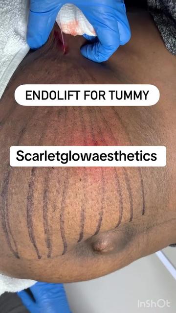 @SCARLETGLOW_AESTHETICS