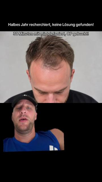 @Mr. Hairtransplant