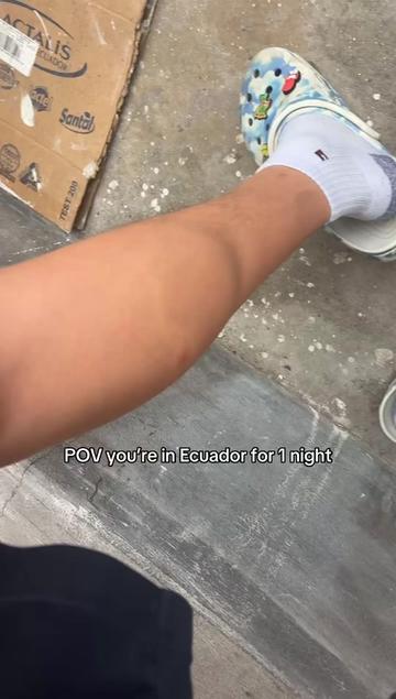 @Jhonn Lopez
