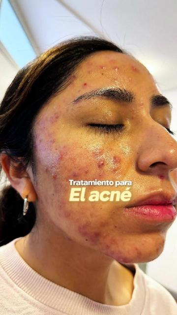 @RebellSpa