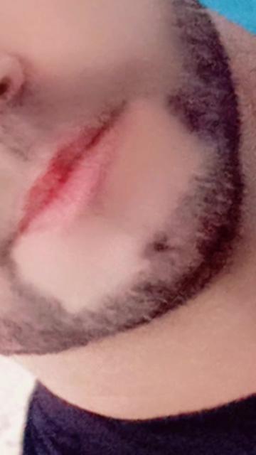 @olhos 👁👁de gato🐈