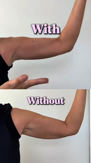 @Skinnies InstantLifts
