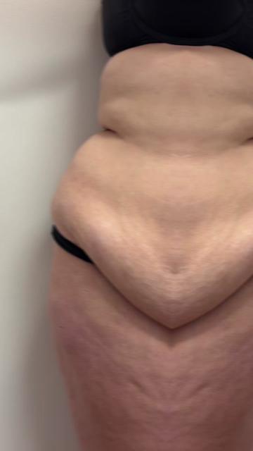 @AESTHETICA LA -Dr.Yaghoubian