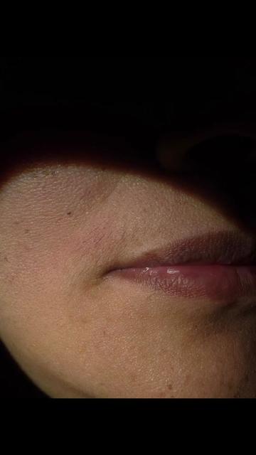 @Neurospice Beauty Electrolysis
