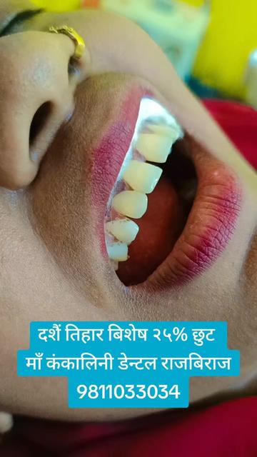 @Dr.Sumit Mandal Dental Surgeon