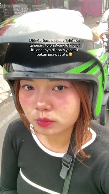 @ichi | glow up journey
