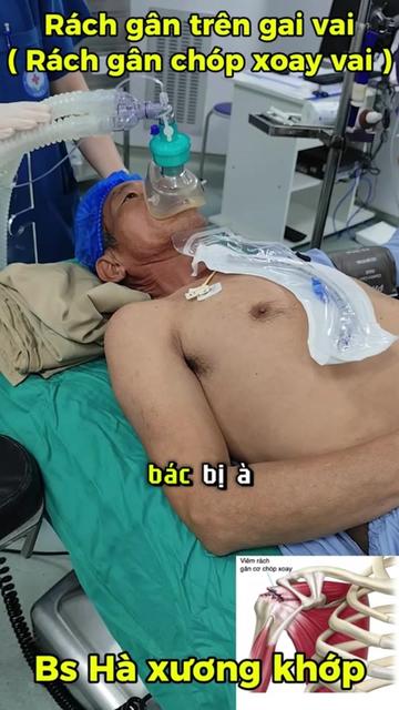 @Chuy&ecirc;n gia xương khớp