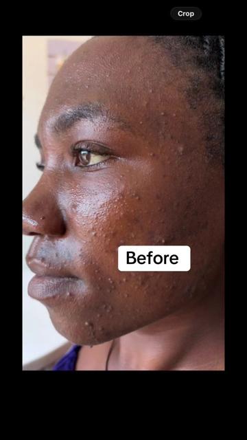 @MAVK SKINCARE SUPPLIERS UG