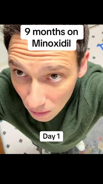 @scalp.hero