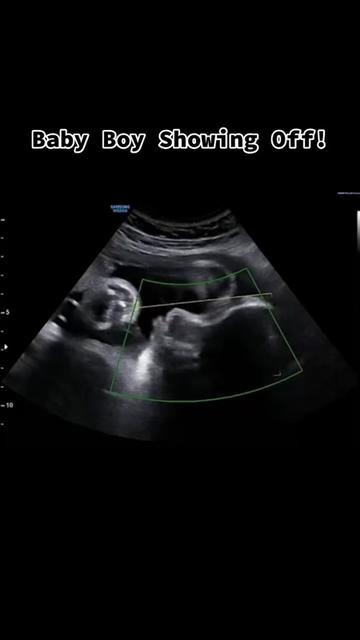 @lilblessings4dhd
