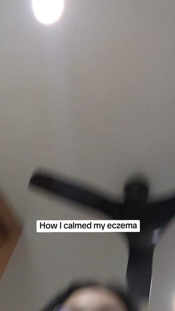 @Grace | TSW & Eczema Recovery