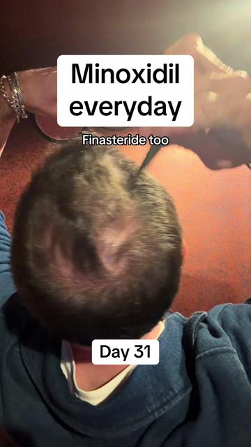 @scalp.hero
