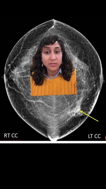 @Dr. Amani Jambhekar