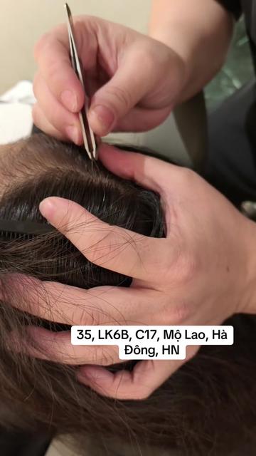 @Nhổ tóc bạc Hà Đông