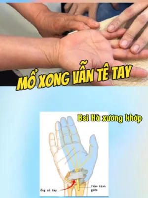 @Chuyên gia xương khớp