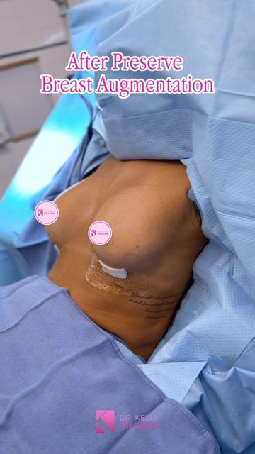 @Kelly Killeen, MD, FACS