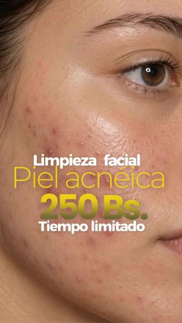 @RebellSpa