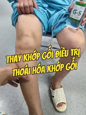 @Chuy&ecirc;n gia xương khớp