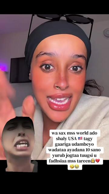 @CADAALO🦋