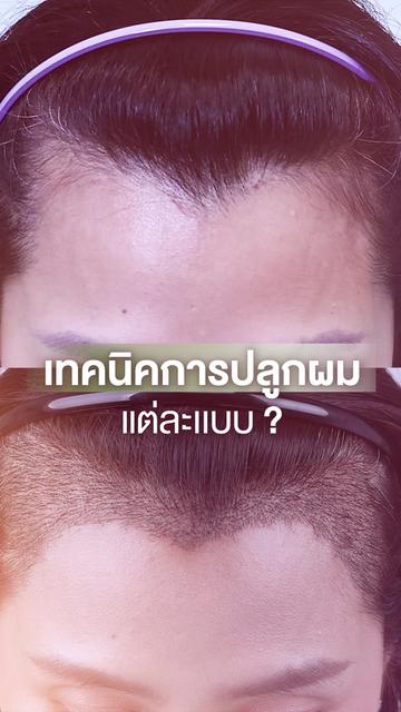 @โรงพยาบาลยันฮี