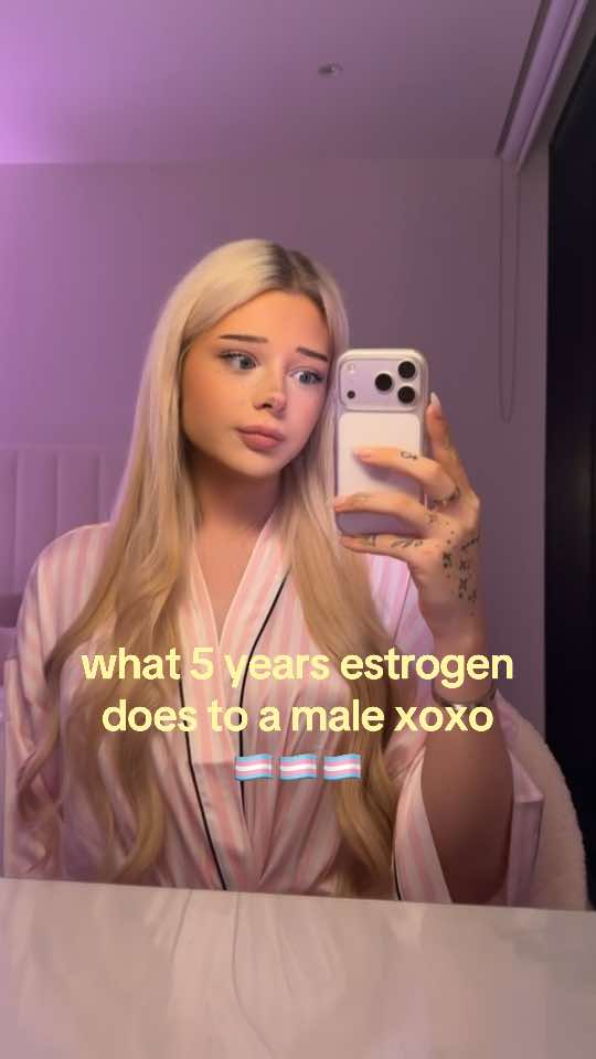 @aubrey