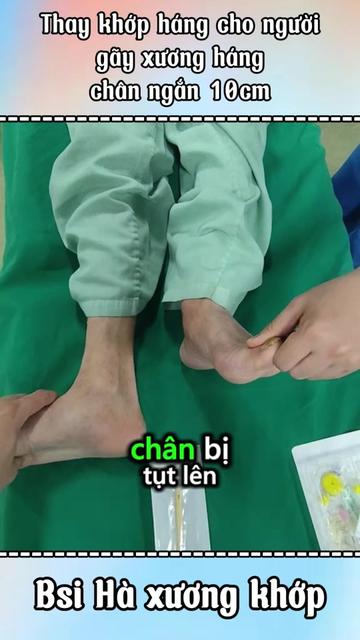 @Chuyên gia xương khớp