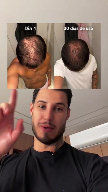 @Vilhena