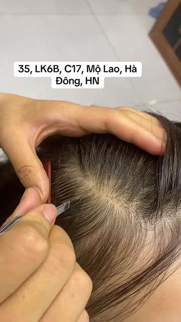 @Nhổ tóc bạc Hà Đông
