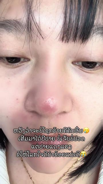 @ສະຖານີເຂົ້າກ່ອງປາກເຊ👩🍳