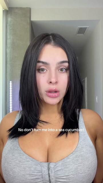 @AIDETTE