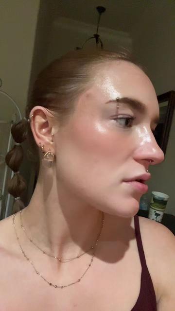 @Bay | Acne Baddie ✨