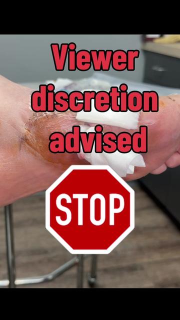 @Deniel Foot and Ankle Center