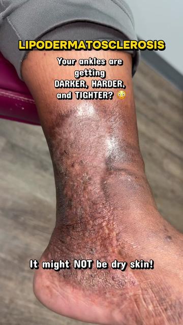@Deniel Foot and Ankle Center