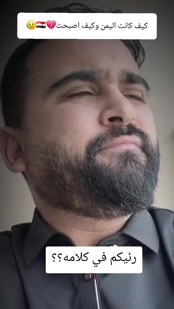 @ali🇾🇪🇺🇲