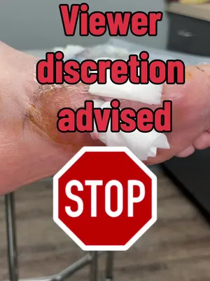 @Deniel Foot and Ankle Center