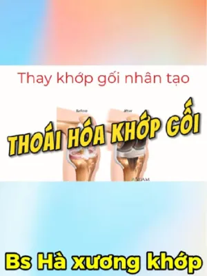 @Chuyên gia xương khớp