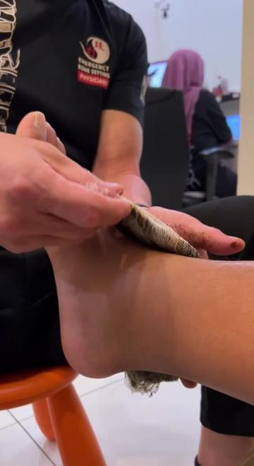 @Osteocare Bone Setting