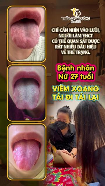 @Triều Gia Y Dưỡng