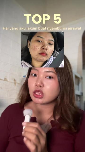 @ichi | glow up journey