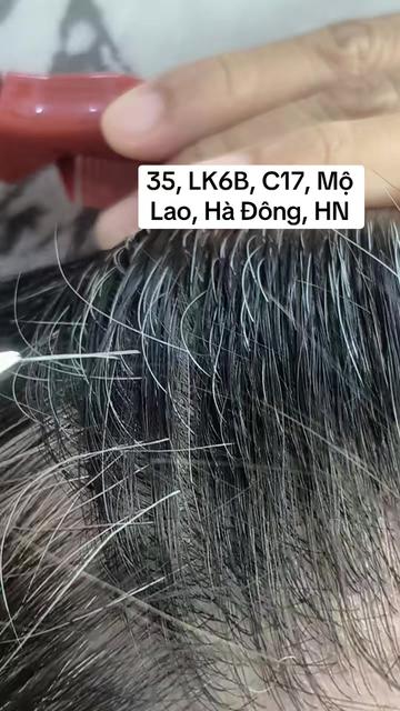 @Nhổ tóc bạc Hà Đông