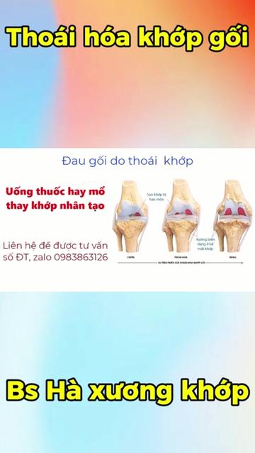 @Chuyên gia xương khớp