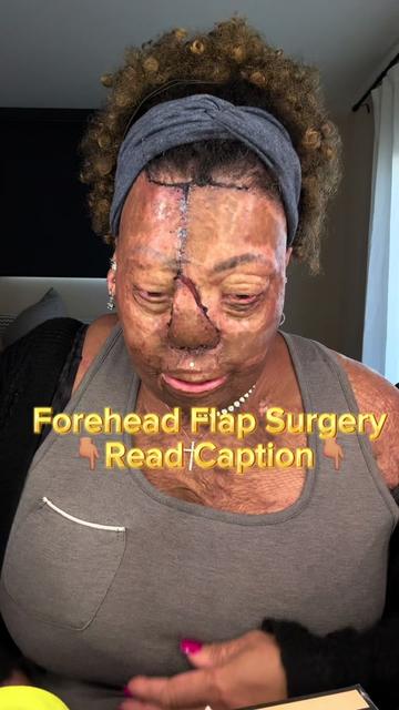 @Burned Beauty 2018®️