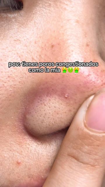 @𝐌𝐢𝐧𝐢 👑